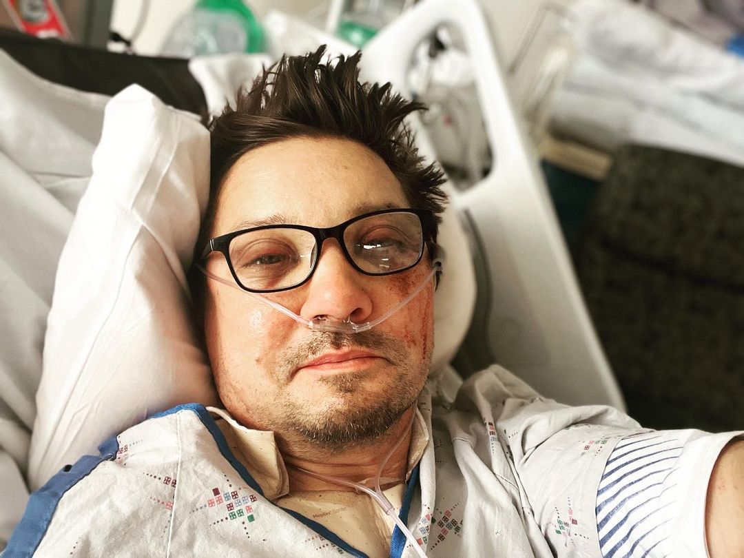 Jeremy Renner shares bruised picture of himself from hospital bed