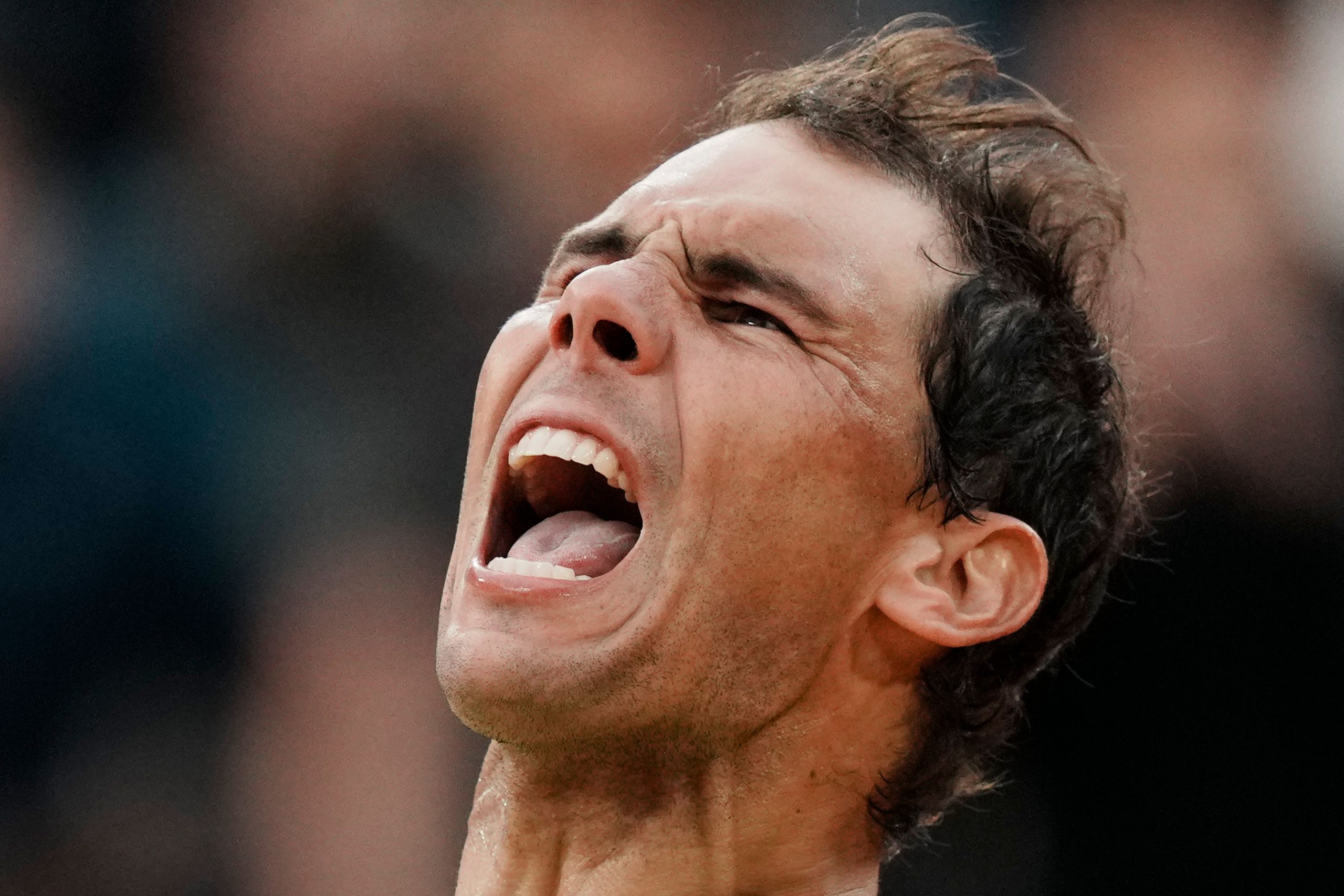 Undeterred by degenerative disease: Rafael Nadal’s fight with Mueller-Weiss