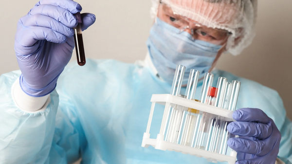 Slovakia begins mass coronavirus testing in global first