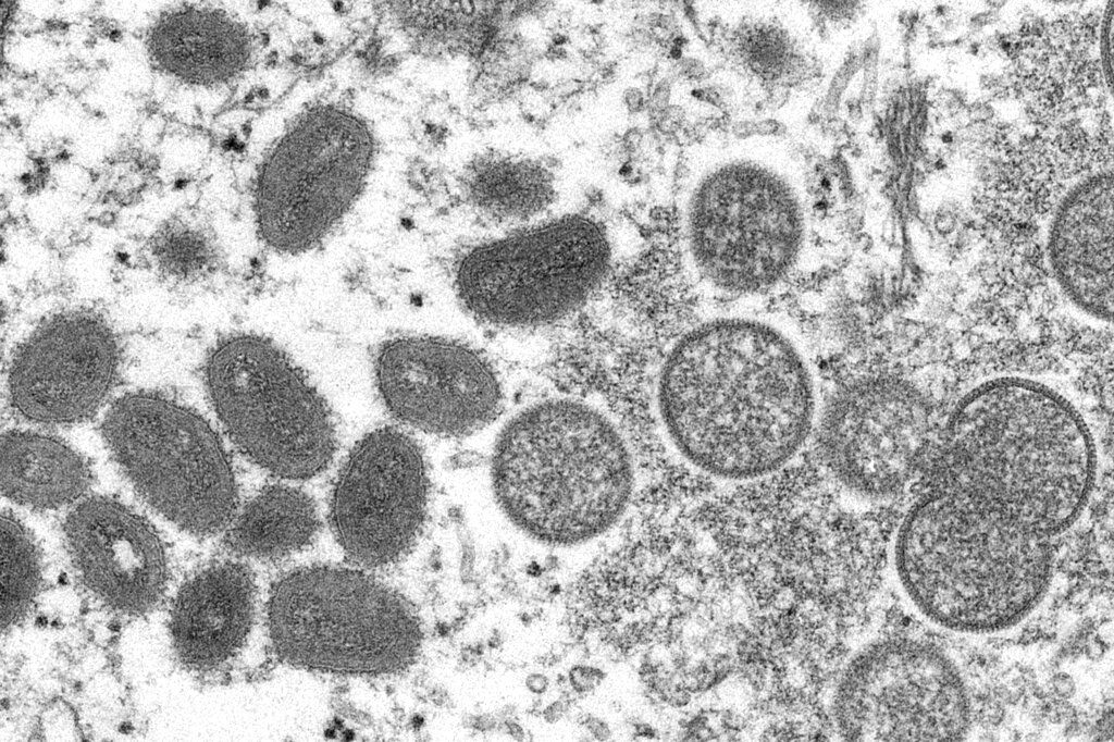 Monkeypox virus may signal dawn of a new STD