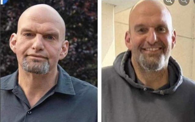 Did John Fetterman get a plastic surgery? US Senator’s pictures after clinical depression treatment go viral