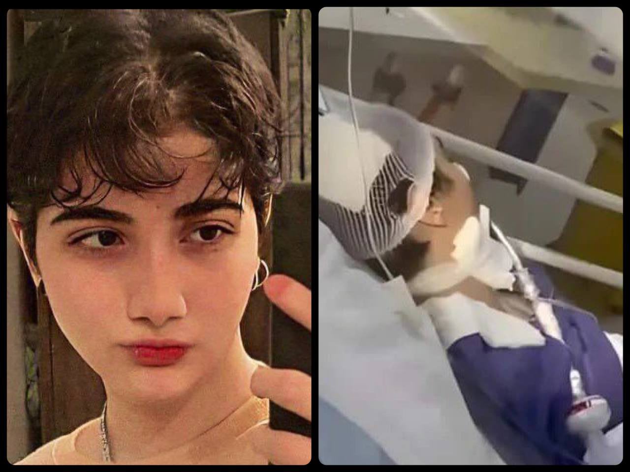 Who was Armita Garavand? Iranian girl assaulted for refusing to wear mandatory hijab declared brain dead