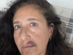 Who is Olga Goldberg, Jewish woman punched in anti-semite attack in Toronto?